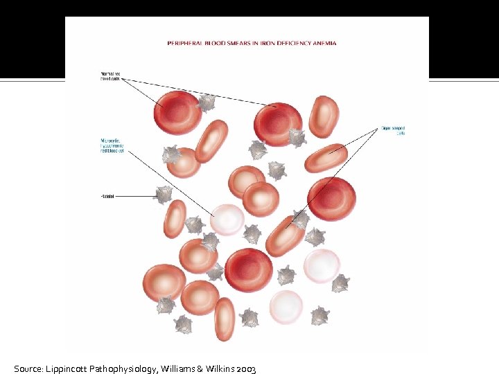 Source: Lippincott Pathophysiology, Williams & Wilkins 2003 