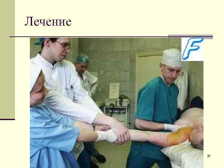 Лечение 37 