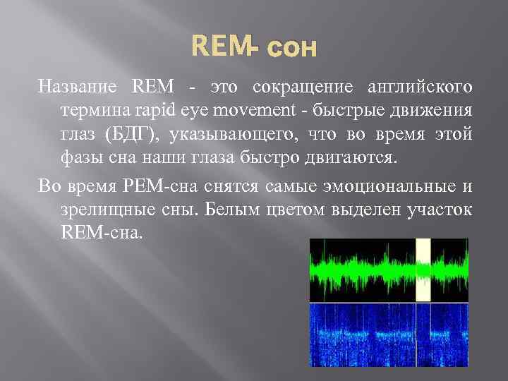 REM- сон Название REM - это сокращение английского термина rapid eye movement - быстрые