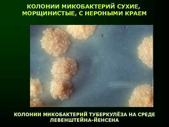 КОЛОНИИ МИКОБАКТЕРИЙ СУХИЕ, МОРЩИНИСТЫЕ, С НЕРОНЫМИ КРАЕМ КОЛОНИИ МИКОБАКТЕРИЙ ТУБЕРКУЛЁЗА НА СРЕДЕ ЛЕВЕНШТЕЙНА-ЙЕНСЕНА 