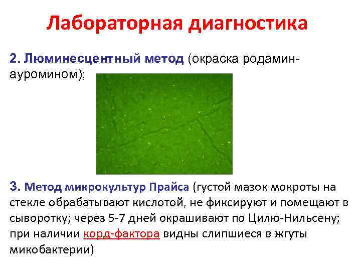 Лабораторная диагностика 2. Люминесцентный метод (окраска родаминауромином); 3. Метод микрокультур Прайса (густой мазок мокроты