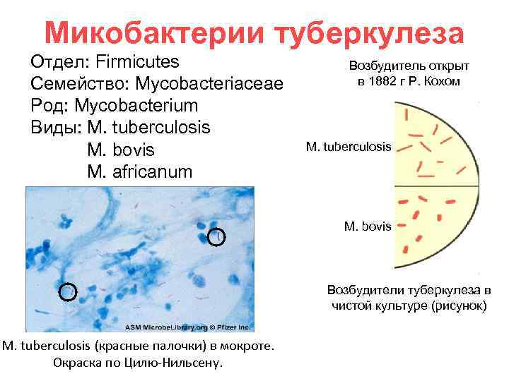 Друзы актиномицетов фото