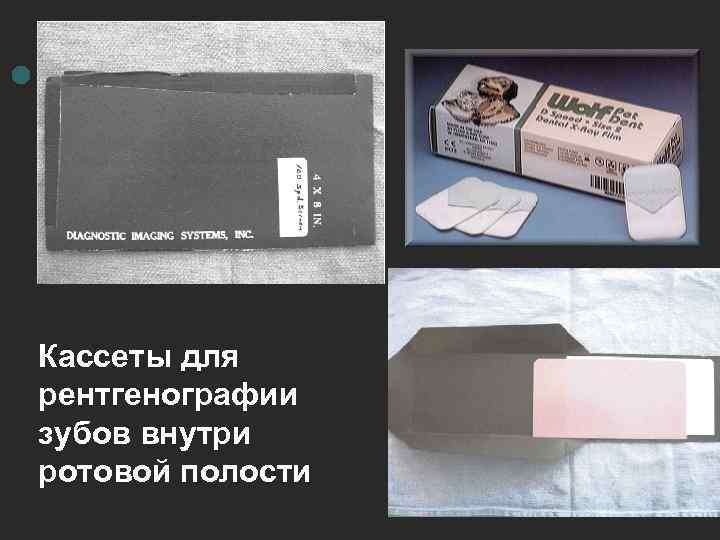 Кассеты для рентгенографии зубов внутри ротовой полости 