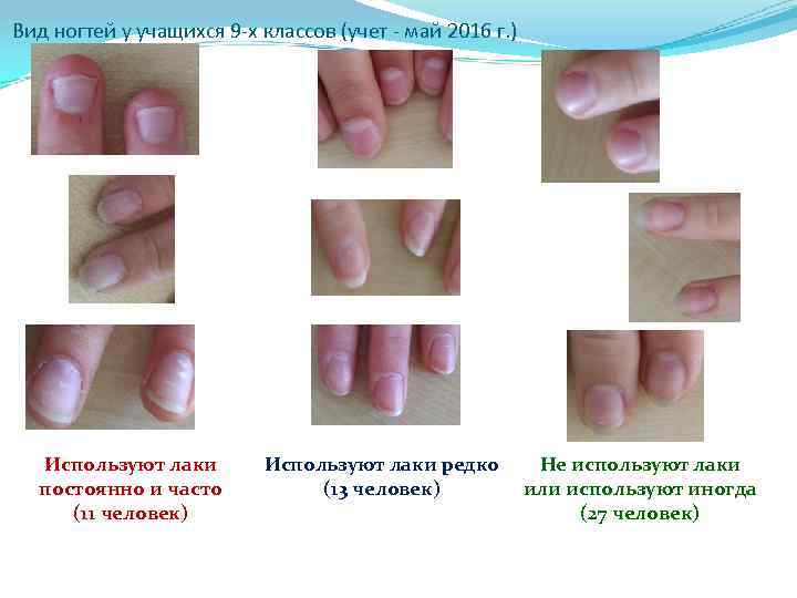 Вид ногтей у учащихся 9 -х классов (учет - май 2016 г. ) Используют
