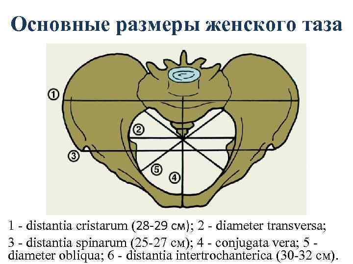 Основные размеры женского таза 1 - distantia cristarum (28 -29 см); 2 - diameter