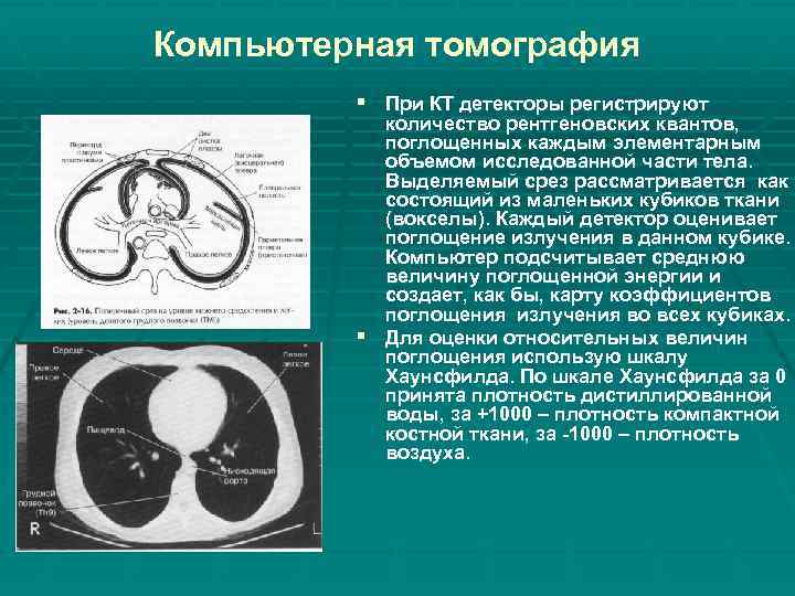 Компьютерная томография § При КТ детекторы регистрируют количество рентгеновских квантов, поглощенных каждым элементарным объемом