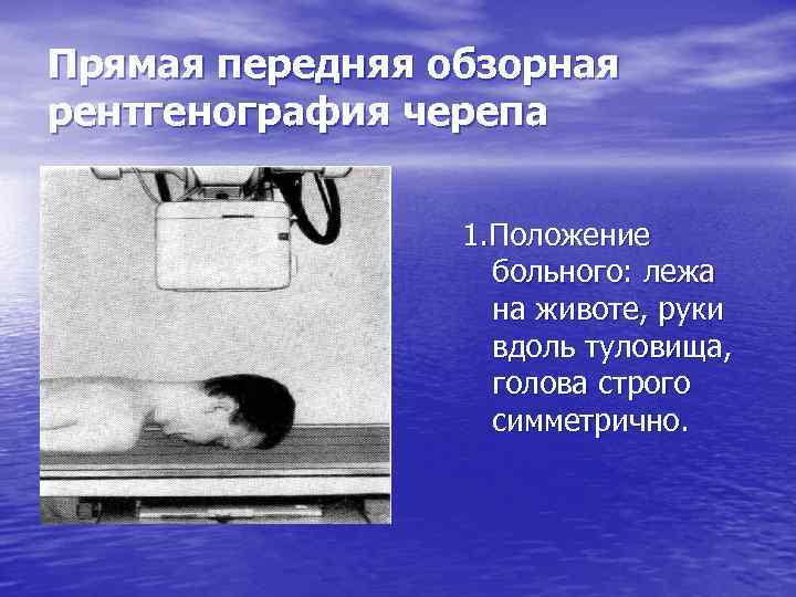 Прямая передняя обзорная рентгенография черепа 1. Положение больного: лежа на животе, руки вдоль туловища,