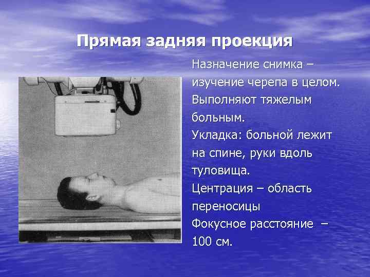 Прямая задняя проекция Назначение снимка – изучение черепа в целом. Выполняют тяжелым больным. Укладка: