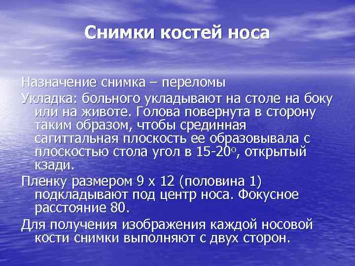 Снимки костей носа Назначение снимка – переломы Укладка: больного укладывают на столе на боку