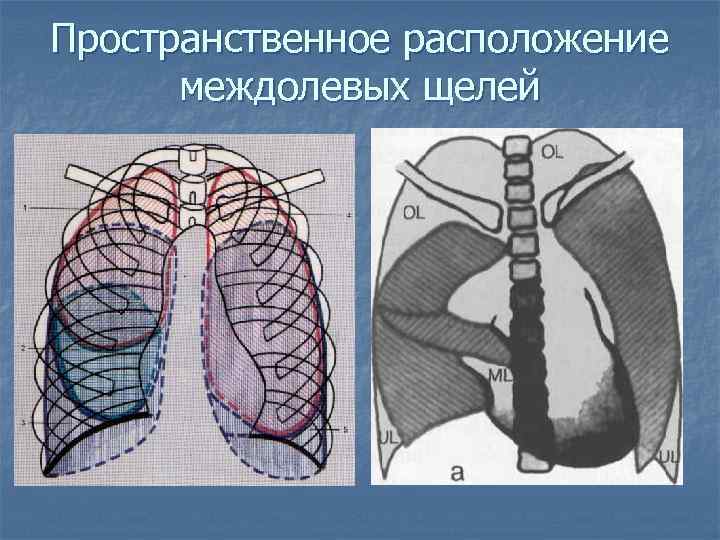 Пространственное расположение междолевых щелей 