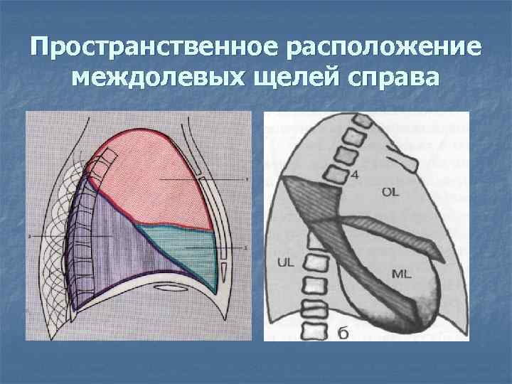 Пространственное расположение междолевых щелей справа 