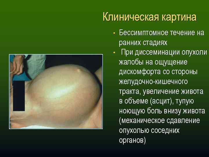 Клиническая картина • • Бессимптомное течение на ранних стадиях При диссеминации опухоли жалобы на
