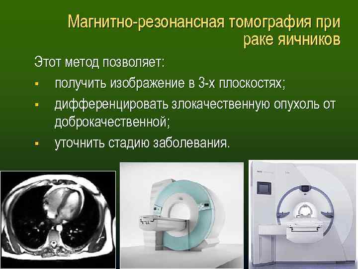 Магнитно-резонансная томография при раке яичников Этот метод позволяет: § получить изображение в 3 -х