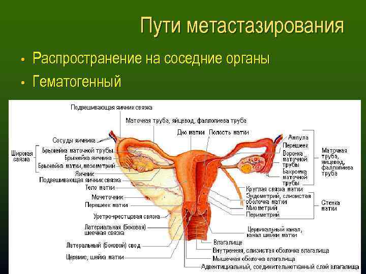 Пути метастазирования • Распространение на соседние органы • Гематогенный 