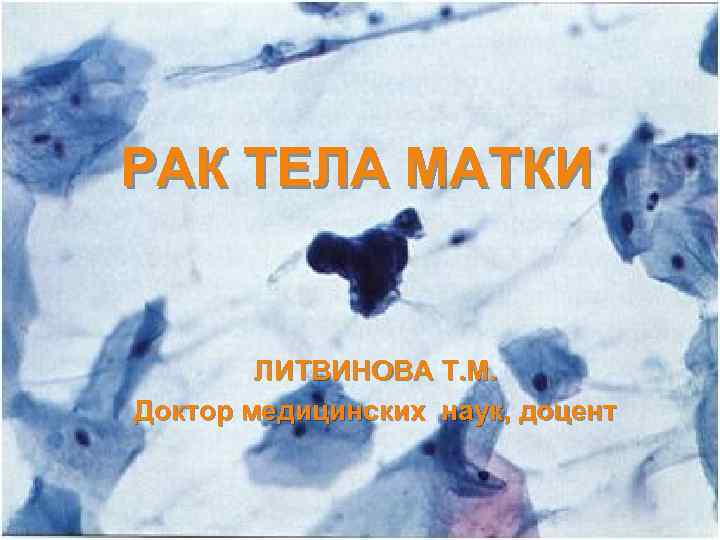 РАК ТЕЛА МАТКИ ЛИТВИНОВА Т. М. Доктор медицинских наук, доцент 