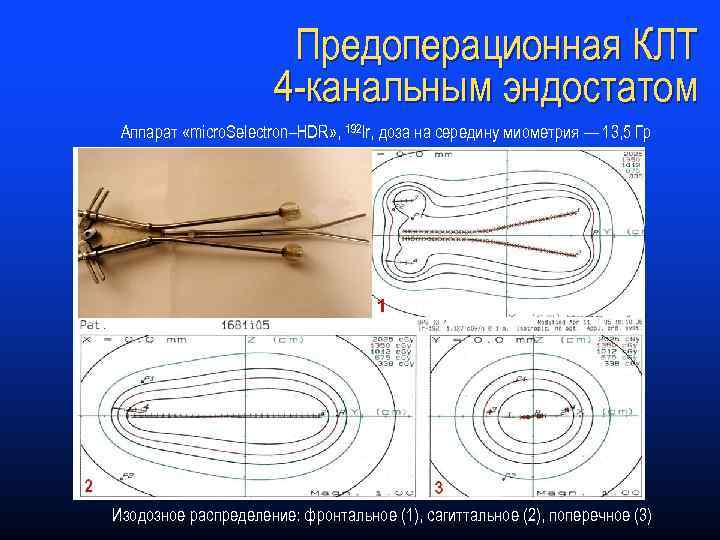 Предоперационная КЛТ 4 -канальным эндостатом Аппарат «micro. Selectron–HDR» , 192 Ir, доза на середину