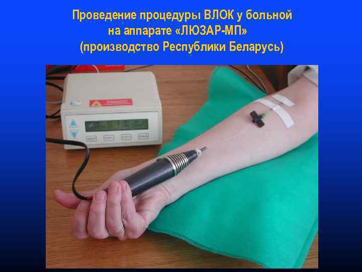 Проведение процедуры ВЛОК у больной на аппарате «ЛЮЗАР-МП» (производство Республики Беларусь) 
