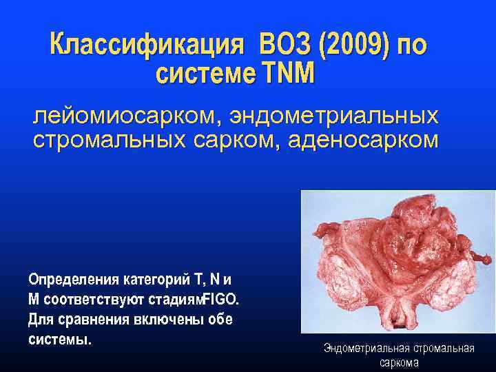 Классификация ВОЗ (2009) по системе TNM лейомиосарком, эндометриальных стромальных сарком, аденосарком Определения категорий Т,