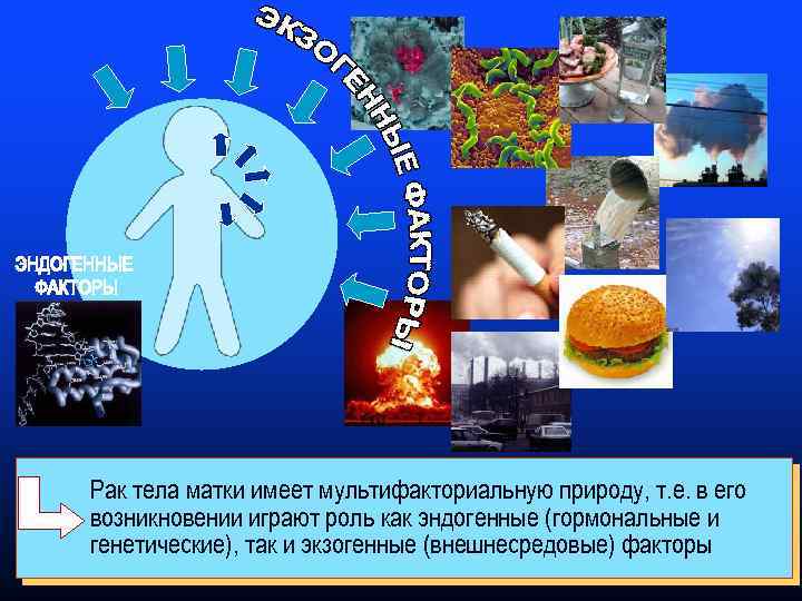 Рак тела матки имеет мультифакториальную природу, т. е. в его возникновении играют роль как