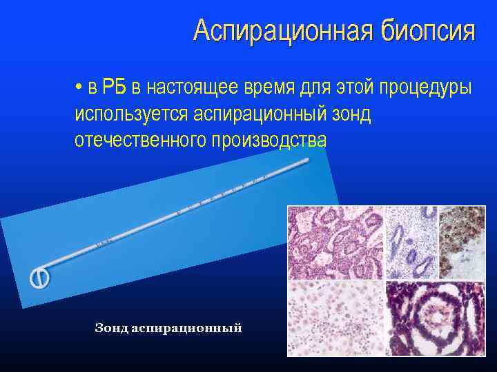 Аспирационная биопсия отзывы