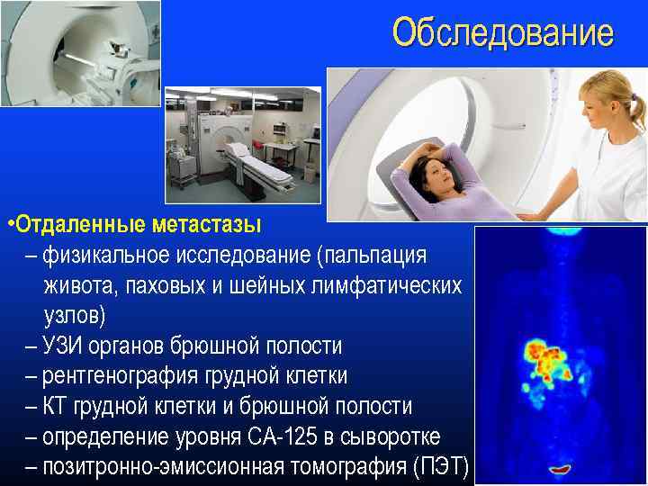Обследование • Отдаленные метастазы – физикальное исследование (пальпация живота, паховых и шейных лимфатических узлов)