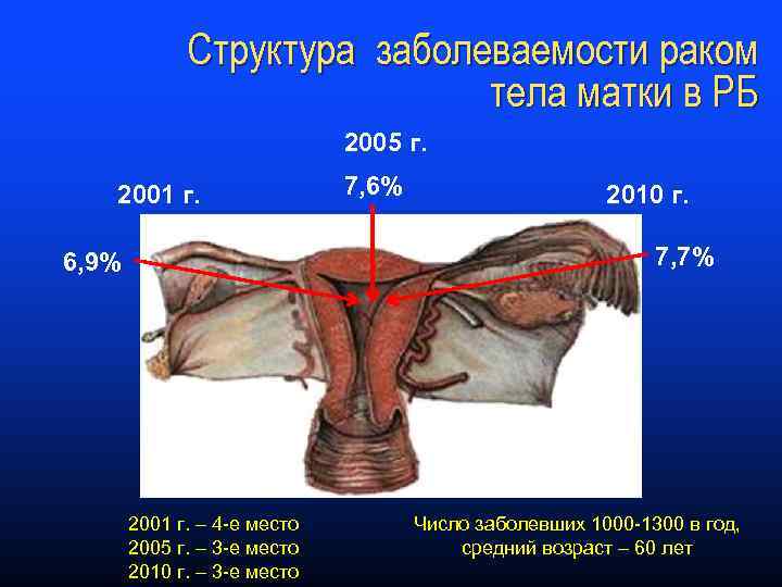 Рак тела матки картинки