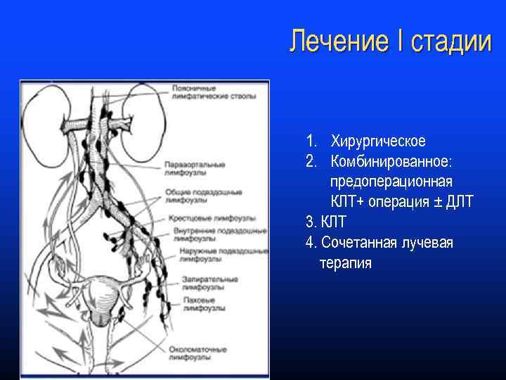 Лечение I стадии 1. Хирургическое 2. Комбинированное: предоперационная КЛТ+ операция ± ДЛТ 3. КЛТ