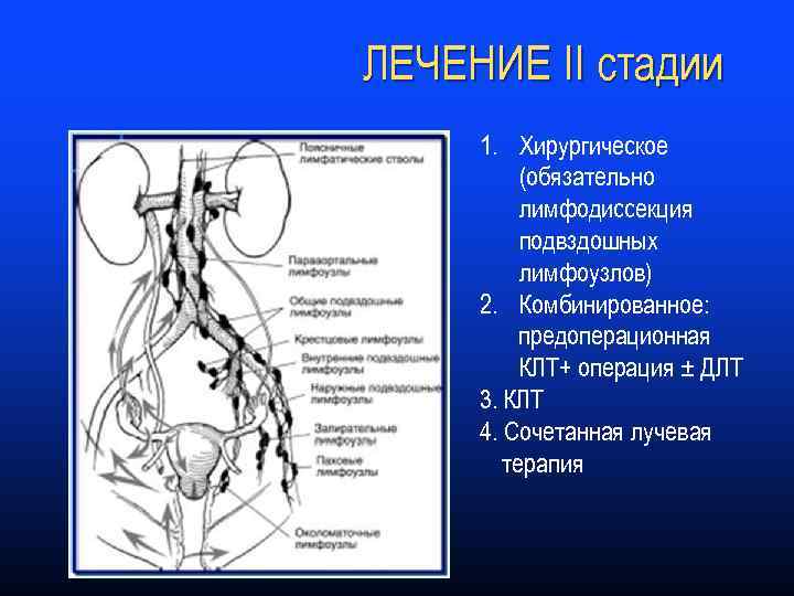 ЛЕЧЕНИЕ II стадии 1. Хирургическое (обязательно лимфодиссекция подвздошных лимфоузлов) 2. Комбинированное: предоперационная КЛТ+ операция