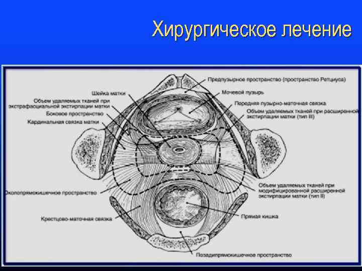 Хирургическое лечение 