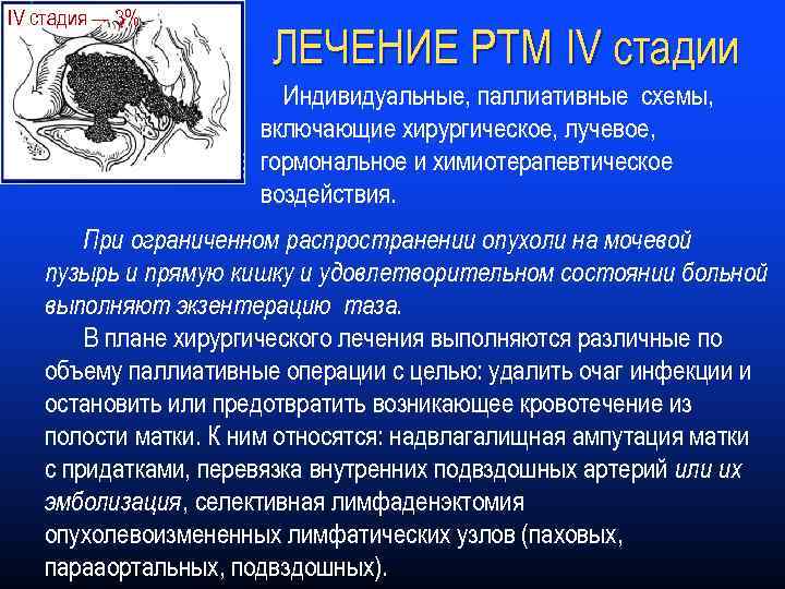 IV стадия — 3% ЛЕЧЕНИЕ РТМ IV стадии Индивидуальные, паллиативные схемы, включающие хирургическое, лучевое,