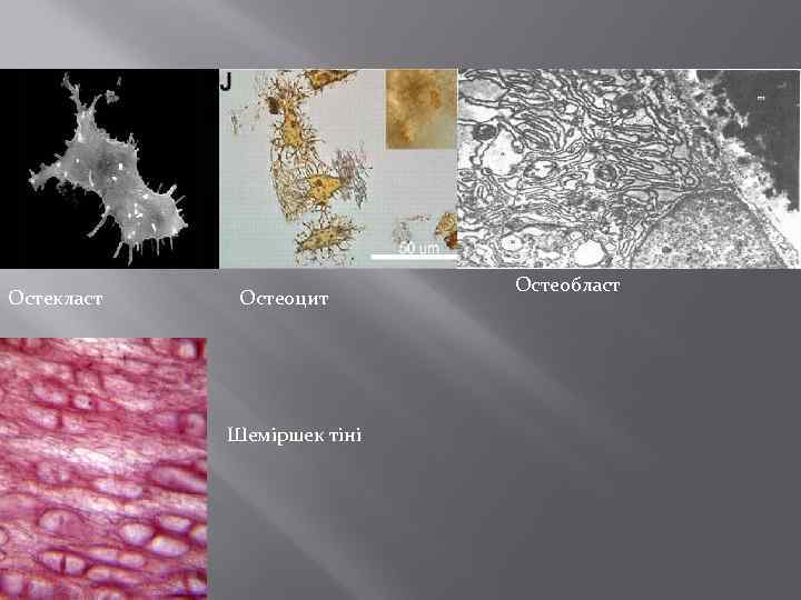 Остекласт Остеоцит Шеміршек тіні Остеобласт 