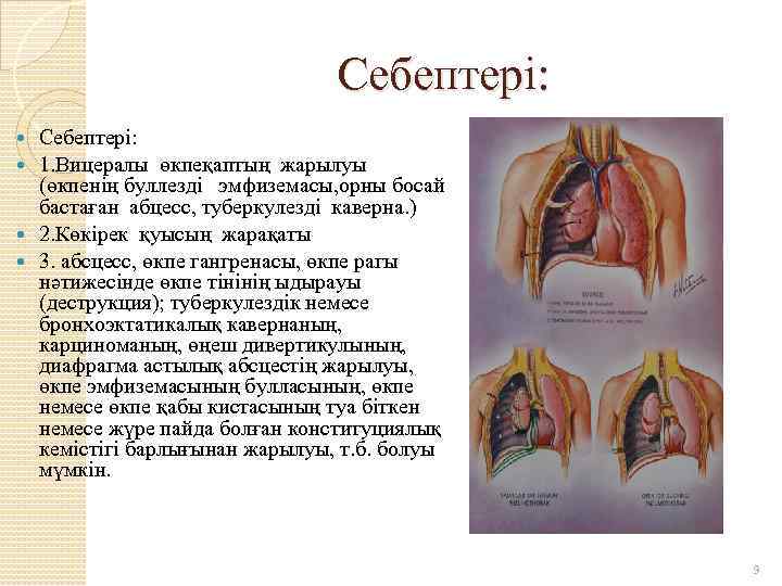 Себептері: 1. Вицералы өкпеқаптың жарылуы (өкпенің буллезді эмфиземасы, орны босай бастаған абцесс, туберкулезді каверна.