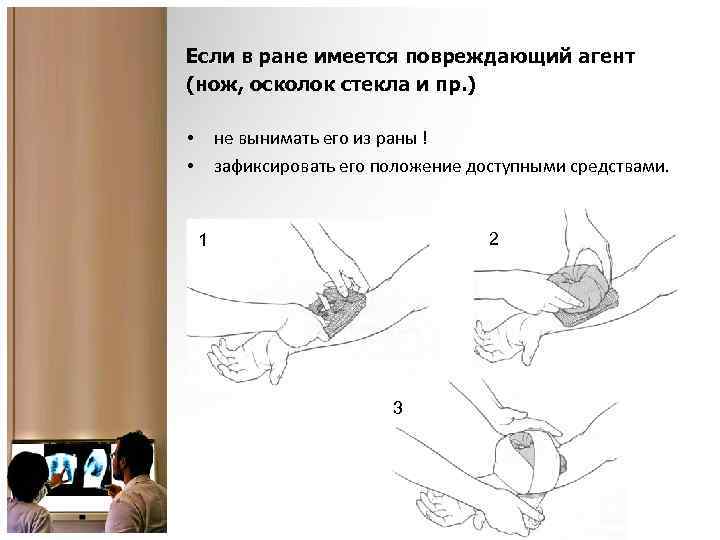 Если в ране имеется повреждающий агент (нож, осколок стекла и пр. ) не вынимать