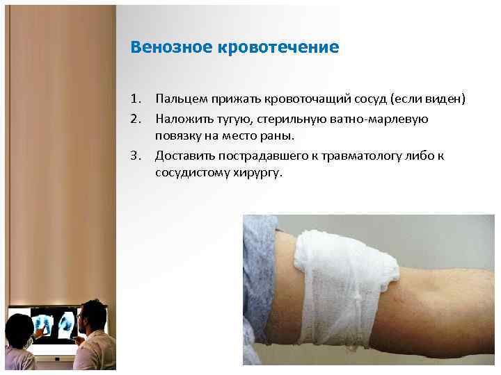 Венозное кровотечение 1. Пальцем прижать кровоточащий сосуд (если виден) 2. Наложить тугую, стерильную ватно-марлевую