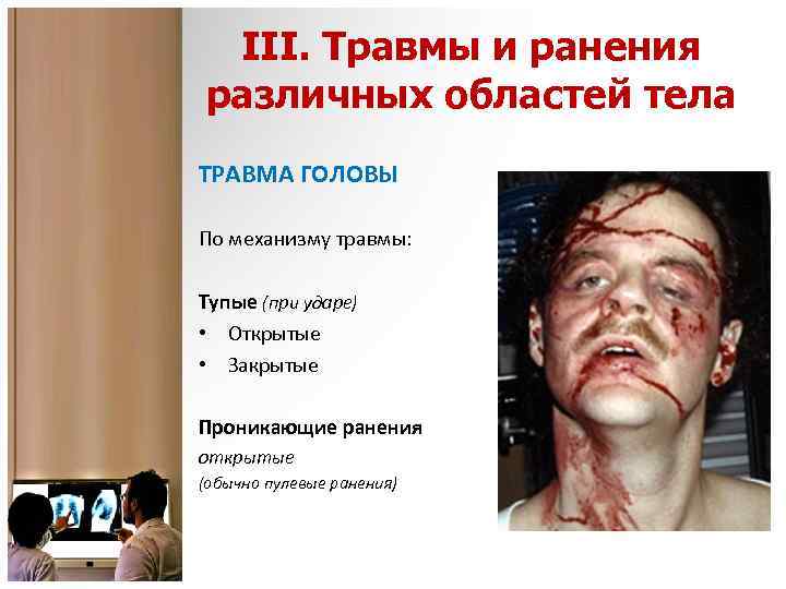 III. Травмы и ранения различных областей тела ТРАВМА ГОЛОВЫ По механизму травмы: Тупые (при