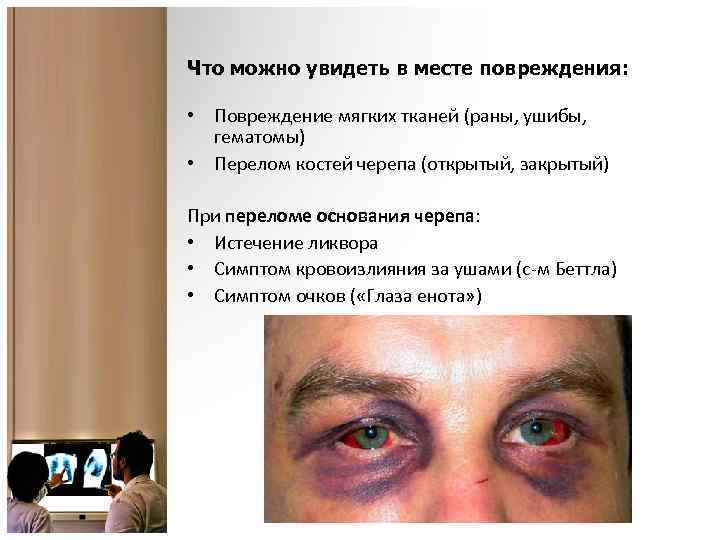 Что можно увидеть в месте повреждения: • Повреждение мягких тканей (раны, ушибы, гематомы) •