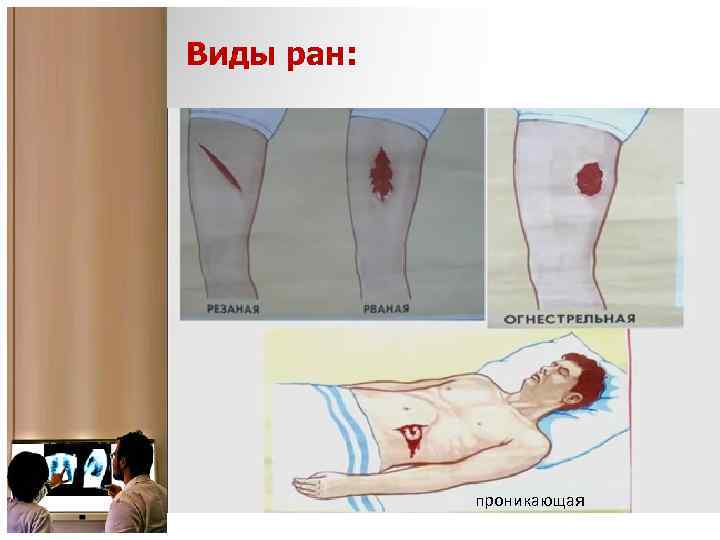 Виды ран: проникающая 