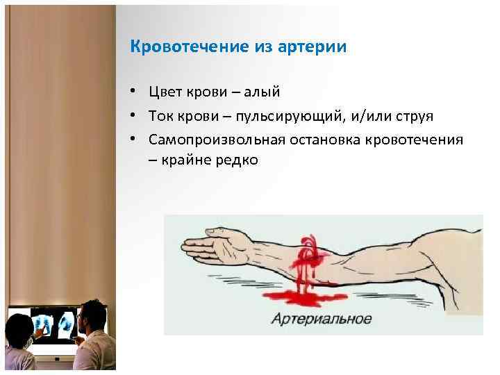 Кровотечение из артерии • Цвет крови – алый • Ток крови – пульсирующий, и/или