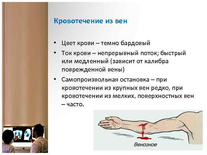 Кровотечение из вен • Цвет крови – темно бардовый • Ток крови – непрерывный