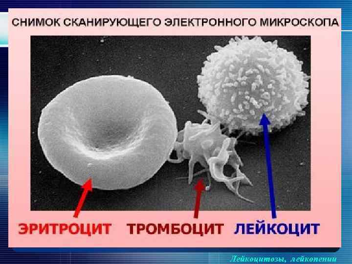 Лейкоцитозы, лейкопении 