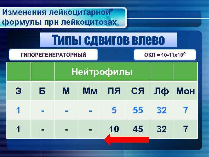 Изменения лейкоцитарной формулы при лейкоцитозах Типы сдвигов влево ОКЛ = 10 -11 х109 ГИПОРЕГЕНЕРАТОРНЫЙ