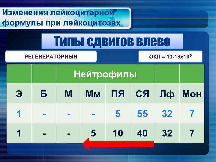 Изменения лейкоцитарной формулы при лейкоцитозах Типы сдвигов влево ОКЛ = 13 -18 х109 РЕГЕНЕРАТОРНЫЙ