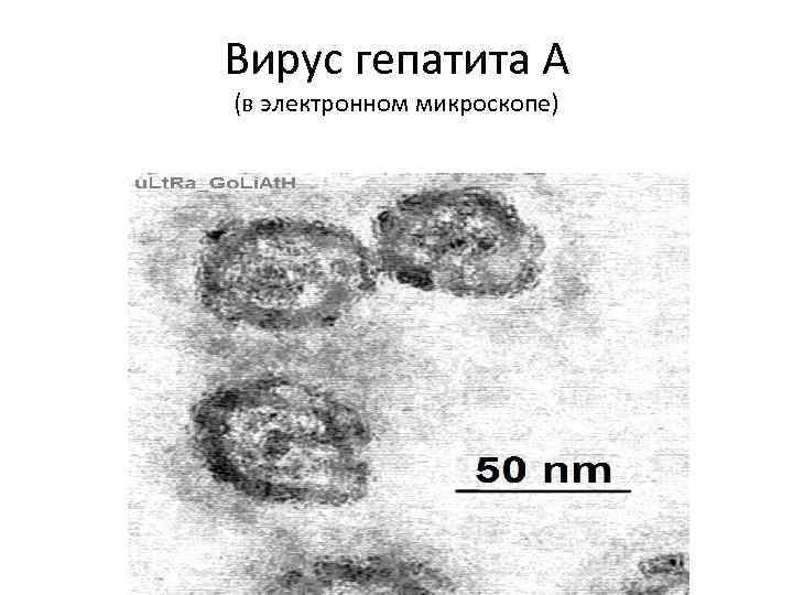 Вирус гепатита А (в электронном микроскопе) 