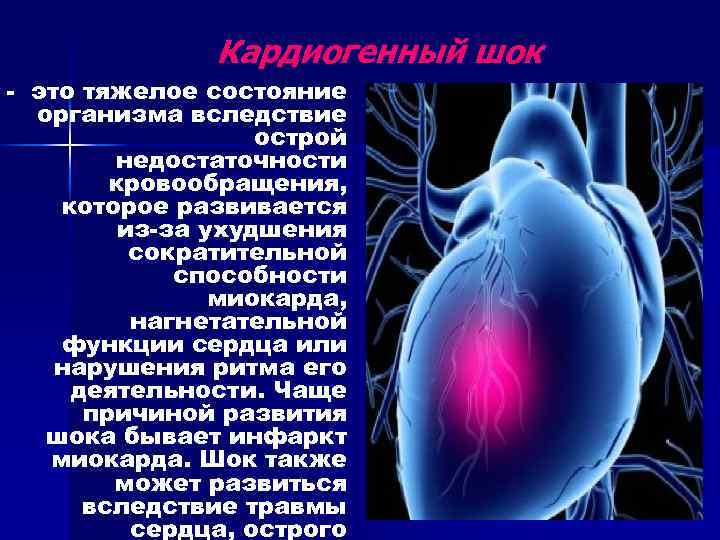 Сердечная сосудистая недостаточность шок. Кардиогенный ШОК факторы риска. Кардиогенный ШОК при острой сердечной недостаточности. Кардиогенный ШОК причины. Причины развития кардиогенного шока.