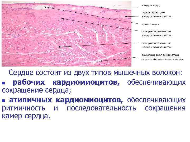 Атипичные кардиомиоциты рисунок