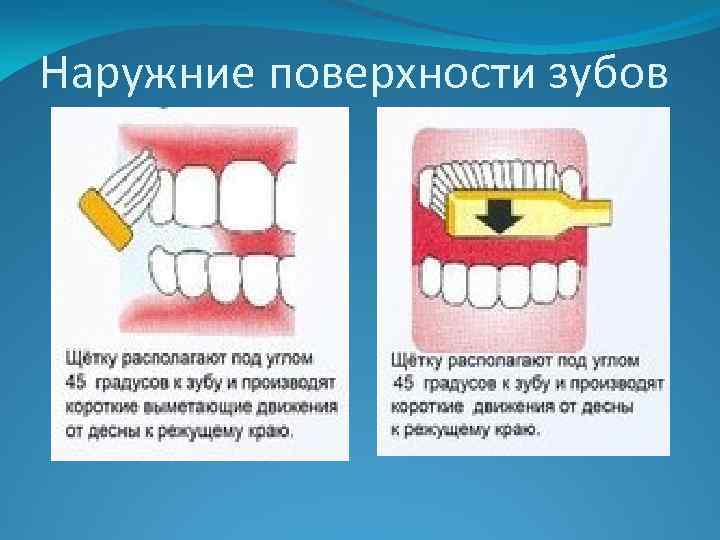 Наружние поверхности зубов 