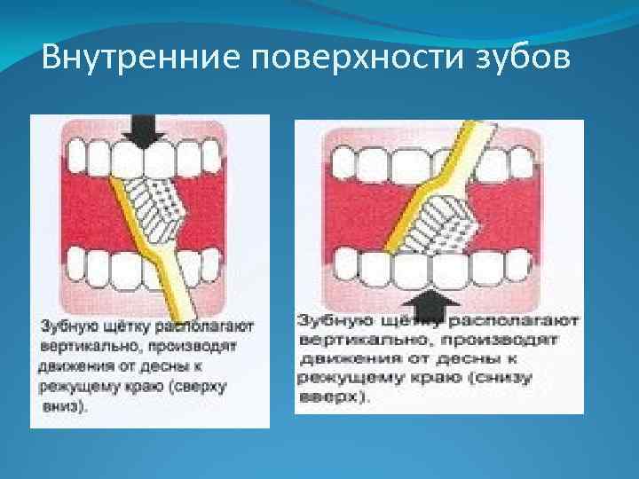 Внутренние поверхности зубов 