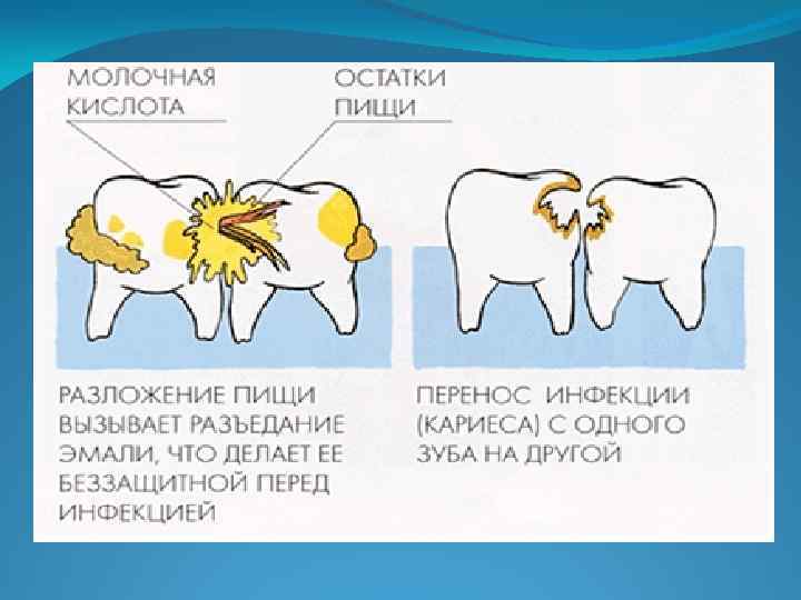 Кариес крым карта