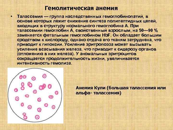 Анемия гемолитического типа. Гемолитическая анемия талассемия. Гемоглобин при гемолитической анемии. Гемолитическая анемия показатели. Гемолитическая анемия схема.