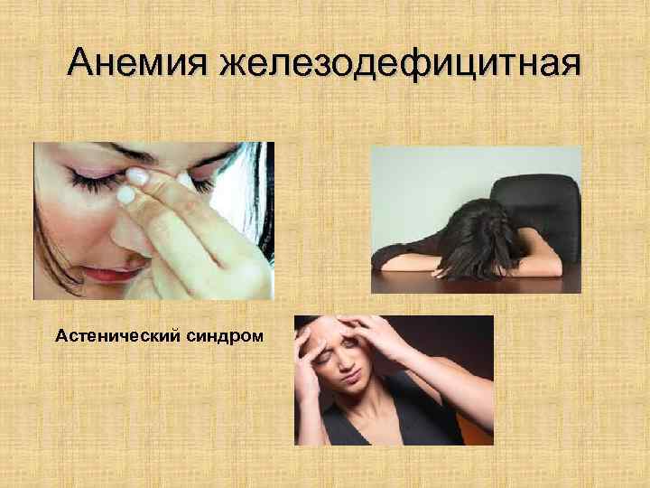 Анемия железодефицитная Астенический синдром 